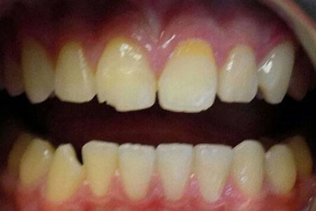 restoration on #4 before image