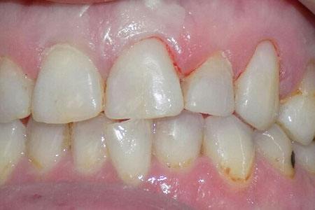 after restoration on #6, 9, & 11 Image